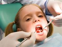 Đánh răng chưa đúng cách, trẻ em Việt thường bị sâu răng