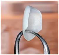 Mặt dán Veneer sứ – Phục hình thẩm mỹ  bảo tồn răng thật